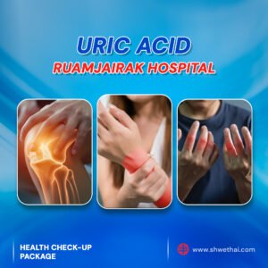 URIC ACID
